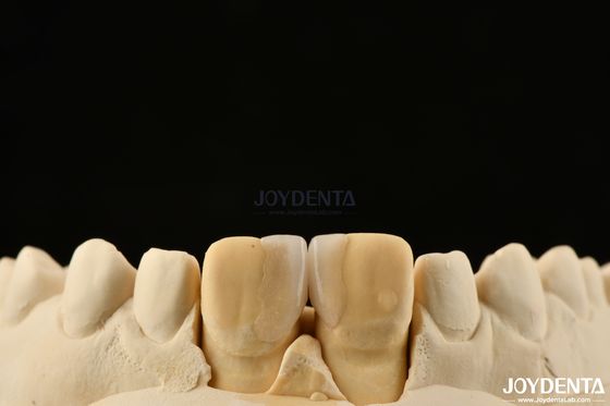 खरीदें 0.2 मिमी मोटाई Microthin Veneers Glass Ceramic Dental Veneers For Front Teeth सामने के दांतों के लिए ग्लास सिरेमिक दंत veneers ऑनलाइन निर्माण
