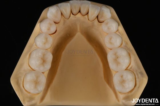 खरीदें 3D मल्टी लेयर डेंटल फुल जिरकोनिया चिपिंग प्रतिरोध प्राकृतिक दांत संरचना ऑनलाइन निर्माण