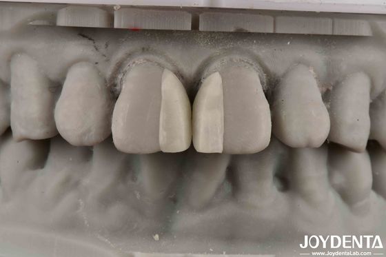 खरीदें घुमावदार सतहें अग्नि प्रतिरोधी माइक्रो फनीर आंतरिक सजावट के लिए ऑनलाइन निर्माण