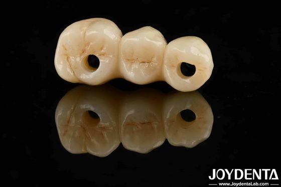 खरीदें उच्च सौंदर्यशास्त्र उच्च झुकने की शक्ति 1000 एमपीए पूर्ण जिरकोनिया मानक के लिए ऑनलाइन निर्माण