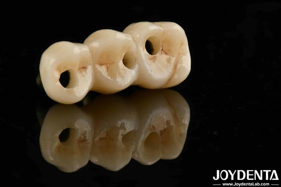 खरीदें उत्कृष्ट जैव संगतता और उच्च शक्ति रंग यथार्थवादी पूर्ण Zirconia के लिए B2B खरीद समाधान ऑनलाइन निर्माण