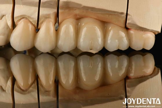 खरीदें थर्मल सदमे के प्रति उच्च प्रतिरोध के साथ सफेद पूर्ण Zirconia उच्च शक्ति ऑनलाइन निर्माण