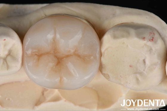 खरीदें बहुपरत पूर्ण जिरकोनिया दंत बहाली के लिए ताकत और सौंदर्यशास्त्र का अंतिम संयोजन ऑनलाइन निर्माण