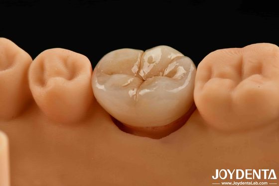 खरीदें उच्च शक्ति और स्थायित्व के लिए प्राकृतिक दिखने वाली बहुपरत पूर्ण जिरकोनिया ऑनलाइन निर्माण