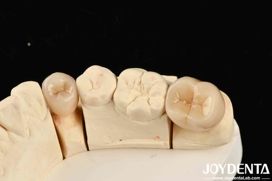 खरीदें उत्कृष्ट जैव संगतता उच्च संक्षारण प्रतिरोध और 1000 एमपीए की झुकने की शक्ति के साथ पूर्ण जिरकोनिया ऑनलाइन निर्माण