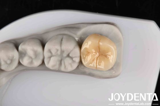 खरीदें थर्मल शॉक और संक्षारण के प्रति उच्च प्रतिरोध उत्कृष्ट रासायनिक स्थिरता के साथ पूर्ण जिरकोनिया ऑनलाइन निर्माण