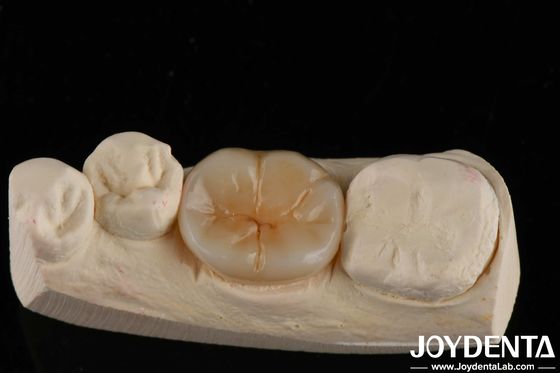 खरीदें 800 एमपीए फ्लेक्सुरल ताकत और 8 एमपीए·एम1/2 फ्रैक्चर कठोरता बहुपरत पूर्ण जिरकोनिया में ताकत अनुप्रयोगों के लिए ऑनलाइन निर्माण