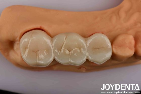 खरीदें प्राकृतिक दिखने वाले सौंदर्यशास्त्र के लिए आपका अंतिम समाधान ऑनलाइन निर्माण