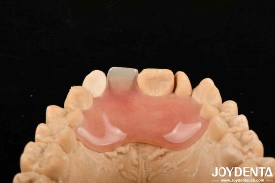 खरीदें विभिन्न विनिर्माण प्रक्रियाओं के लिए उच्च गुप्तता अच्छी लोचदारता लचीला दांत खत्म ऑनलाइन निर्माण