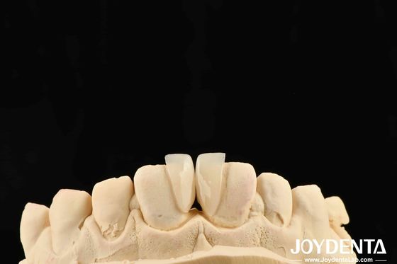 खरीदें उच्च स्थायित्व माइक्रो विनीर 0.2 मिमी मोटाई और विश्वसनीय प्रदर्शन ऑनलाइन निर्माण