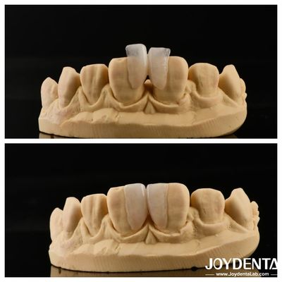 खरीदें इंटीरियर सजावट के लिए माइक्रो वैनर अंतिम समाधान स्थापित करने में आसान मोटाई 0.2 मिमी ऑनलाइन निर्माण