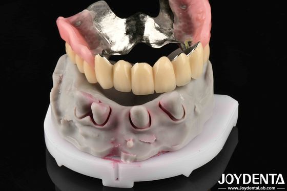 खरीदें दांतों के लिए अत्याधुनिक धातु सामग्री ऑनलाइन निर्माण