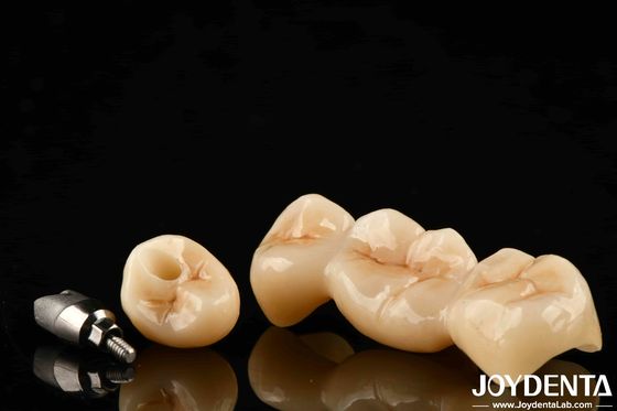 खरीदें मल्टीलेयर फुल जिरकोनिया उच्च दरार प्रतिरोध और लंबे समय तक चलने वाले दंत बहाली के लिए स्थायित्व ऑनलाइन निर्माण