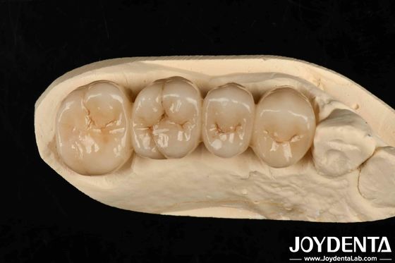 खरीदें बहुपरत पूर्ण जिरकोनिया सफेद शैली के साथ परतें उच्च पारदर्शिता उच्च प्रतिरोध करने के लिए दरार ऑनलाइन निर्माण