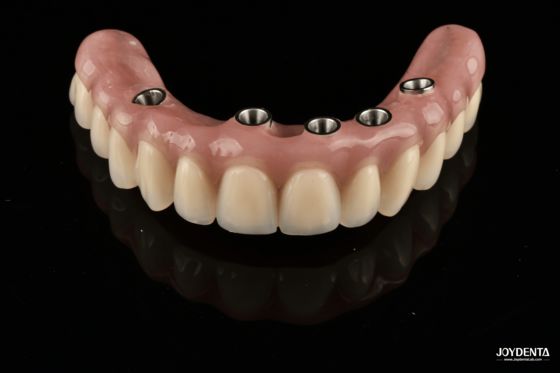 खरीदें Redefining Full Arch Prosthetics: Unmatched Fit and Function with Our Ti-Base Complete Dentures ऑनलाइन निर्माण