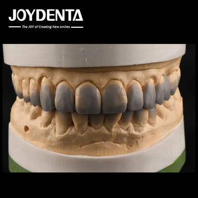 खरीदें अस्थायी उपयोग डायग्नोस्टिक वैक्स अप्स चिकनी बनावट दांत वैक्स अप कस्टम ऑनलाइन निर्माण