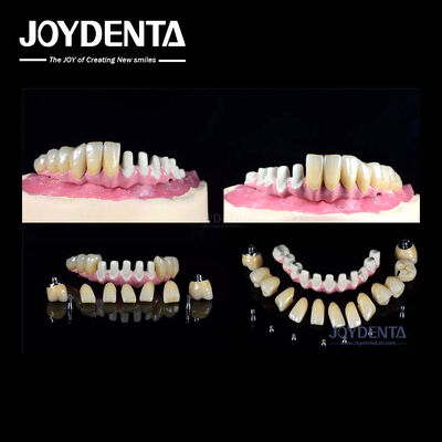 खरीदें पूर्ण आर्क पुनर्स्थापना के लिए कई अंतर्गर्भाशयी दंत प्रत्यारोपण आंतरिक कनेक्शन ऑनलाइन निर्माण