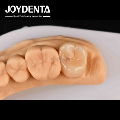 खरीदें उच्च शक्ति Emax Inlay Onlay A2 रंग क्षतिग्रस्त दांतों की बहाली के लिए लंबे समय तक चलने वाला ऑनलाइन निर्माण