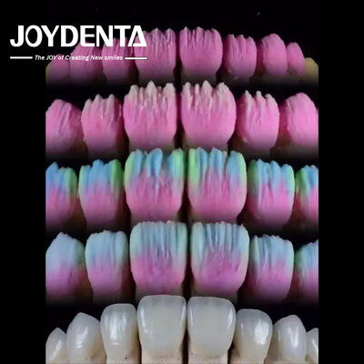 खरीदें The Joydenta Ceramic Veneer Process ऑनलाइन निर्माण