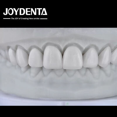 खरीदें Visualize the Result, Secure the Case: Our Diagnostic Wax-Up Service ऑनलाइन निर्माण