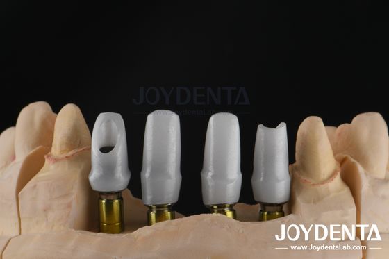 कस्टम दंत प्रत्यारोपण एकल या एकाधिक इकाई बहाली के लिए Zirconia Abutment