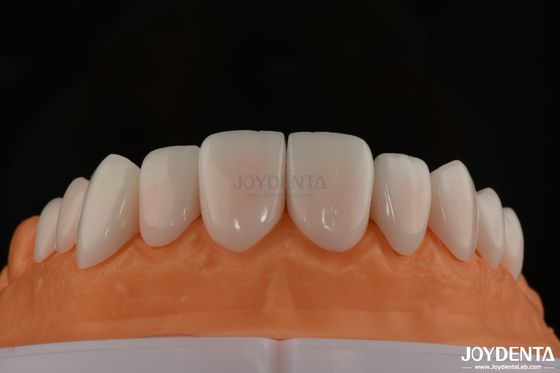 A1-A4 Ips Emax प्रेस पोर्सिलेन डेंटल फ़नीर दाग प्रतिरोधी अनुकूलन योग्य आकार