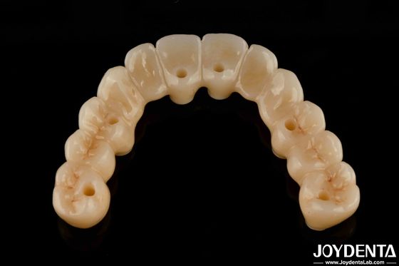 उच्च लचीलापन टाइटेनियम आधार के साथ Zirconia हाइब्रिड ब्रिज उच्च सौंदर्य