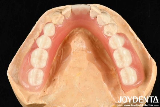 विविध और हल्के राल सामग्री एक्रिलिक प्रोटेक्ट फिनिश