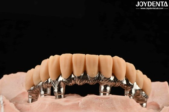 पीला राल अस्थायी दांत चिकनी सतह उपचार सटीक और स्थिर