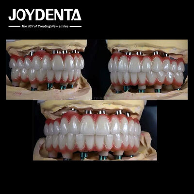 10 मिमी टाइटेनियम मल्टीपल टूथ इम्प्लांट