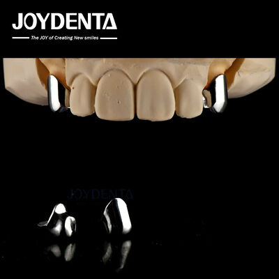 सटीक हटाने योग्य प्रोस्थेसिस दंत प्रत्यारोपण संलग्नक आसान साफ आरामदायक फिट