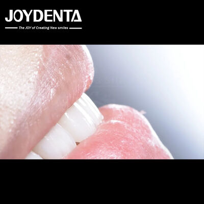 लंबे समय तक चलने वाला दंत कम्पोजिट फनीर अच्छी जैव संगतता कोई ड्रॉप ऑफ पोर्सिलेन फनीर नहीं