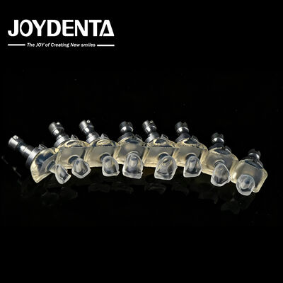 उच्च पारदर्शी कांच चीनी मिट्टी दांत veneers उच्च शक्ति 0.3-0.8 मिमी मोटाई