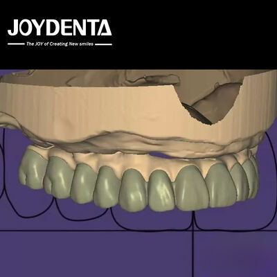 व्यक्तिगत डिजाइन डिजिटल डायग्नोस्टिक वैक्स अप लैब सॉफ्टवेयर निर्बाध एकीकरण